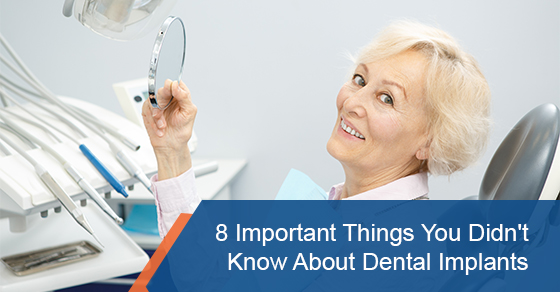8 Important Things You Didn’t Know About Dental Implants