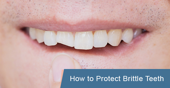 How to Protect Brittle Teeth
