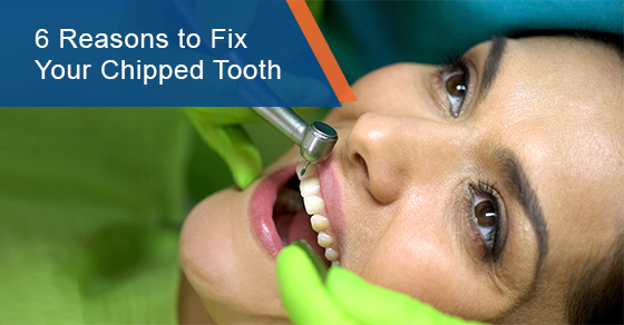 6 Reasons to Fix Your Chipped Tooth
