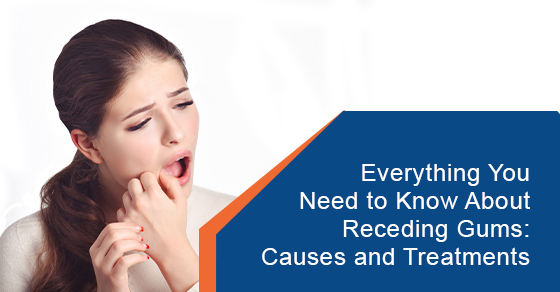 Everything You Need to Know About Receding Gums: Causes and Treatments