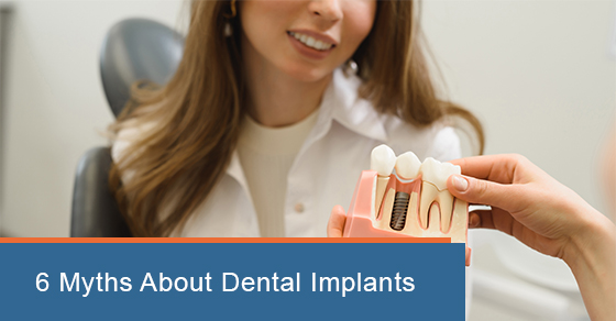 6 Myths About Dental Implants