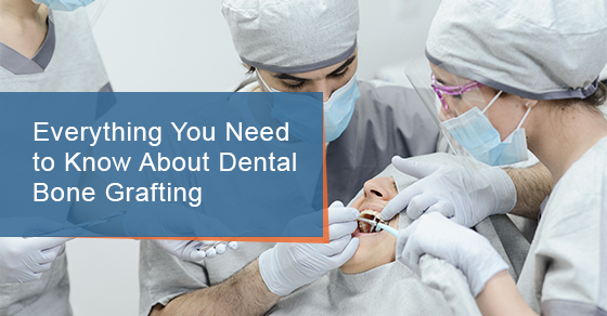 Everything You Need to Know About Dental Bone Grafting