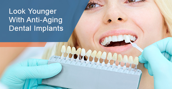 Look Younger With Anti-aging Dental Implants