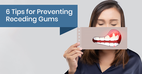 6 tips for preventing receding gums