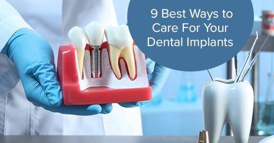 9 Best Ways to Care For Your Dental Implants