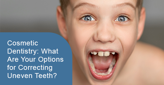 Cosmetic Dentistry: What Are Your Options for Correcting Uneven Teeth?