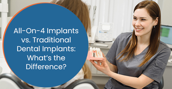 All-On-4 Implants vs. Traditional Dental Implants: What’s the Difference?