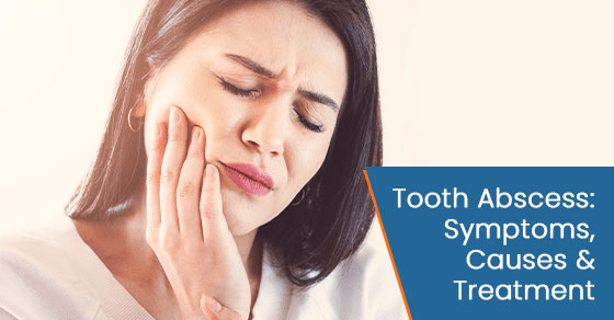 Tooth abscess: symptoms, causes & treatment