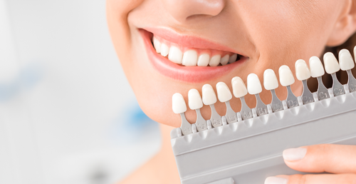 Cosmetic Dentistry Toronto