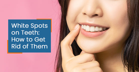 White spots on teeth: How to get rid of them
